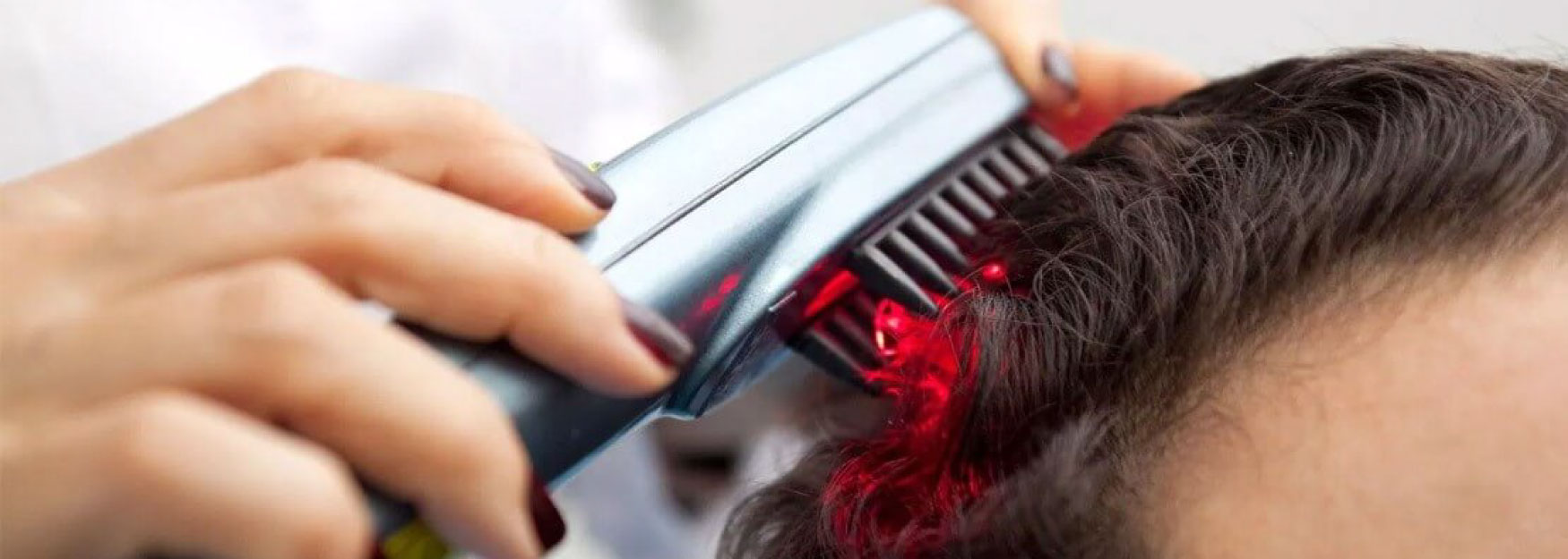 Low Level Laser Therapy For Hair Loss – The Ultimate Guide Image