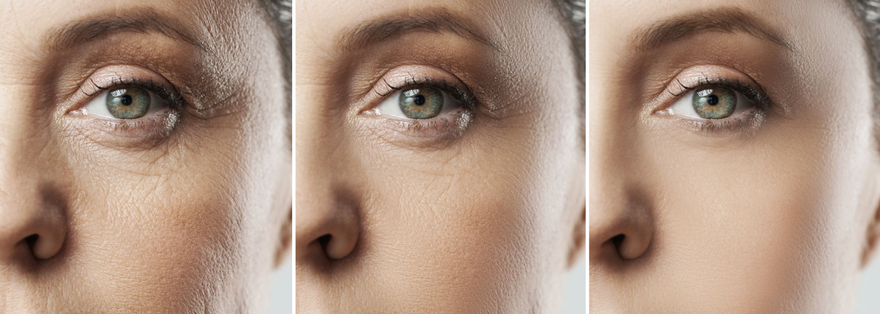 The Top 10 Anti-Aging Tips for 2016 Image