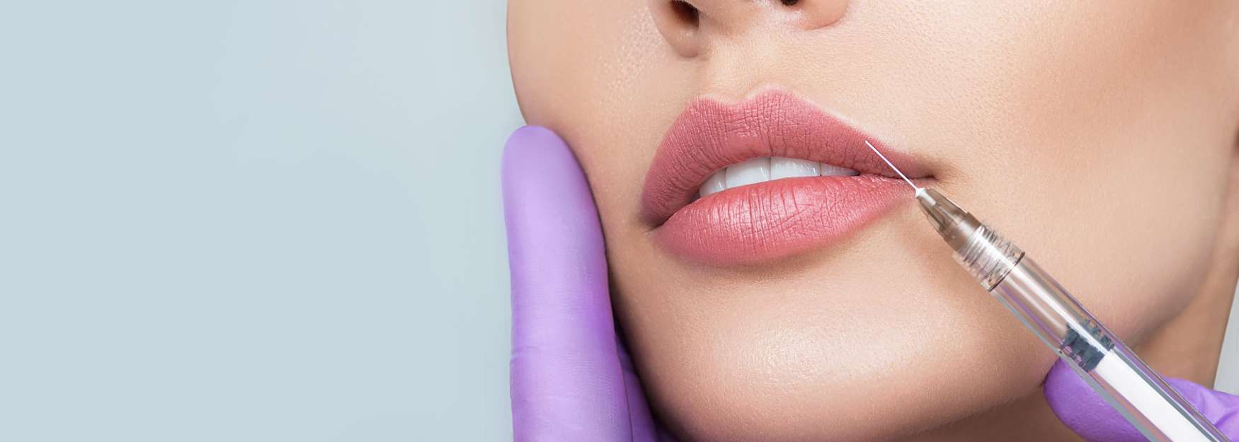 Discover the Benefits of Lip Fillers for Natural-Looking Results Image