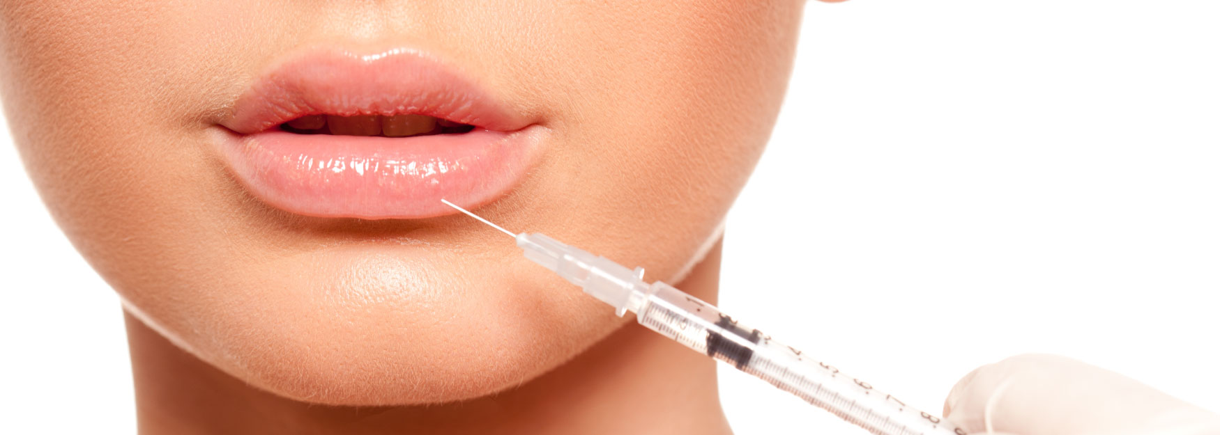 The Perfect Pout with Juvéderm Image