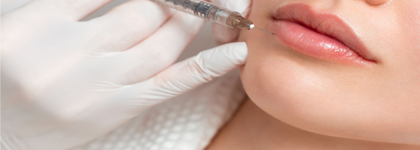 Everything You Need to Know About Lip Filler Image