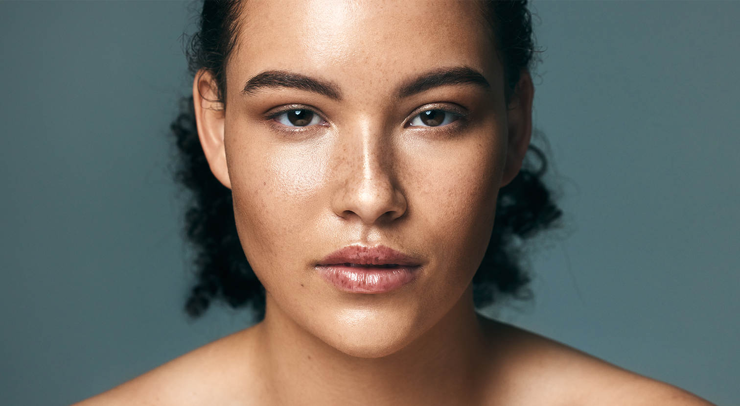 Pores Treatments in West Los Angeles, CA Image