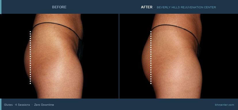 Glutes — Female · 4 Sessions