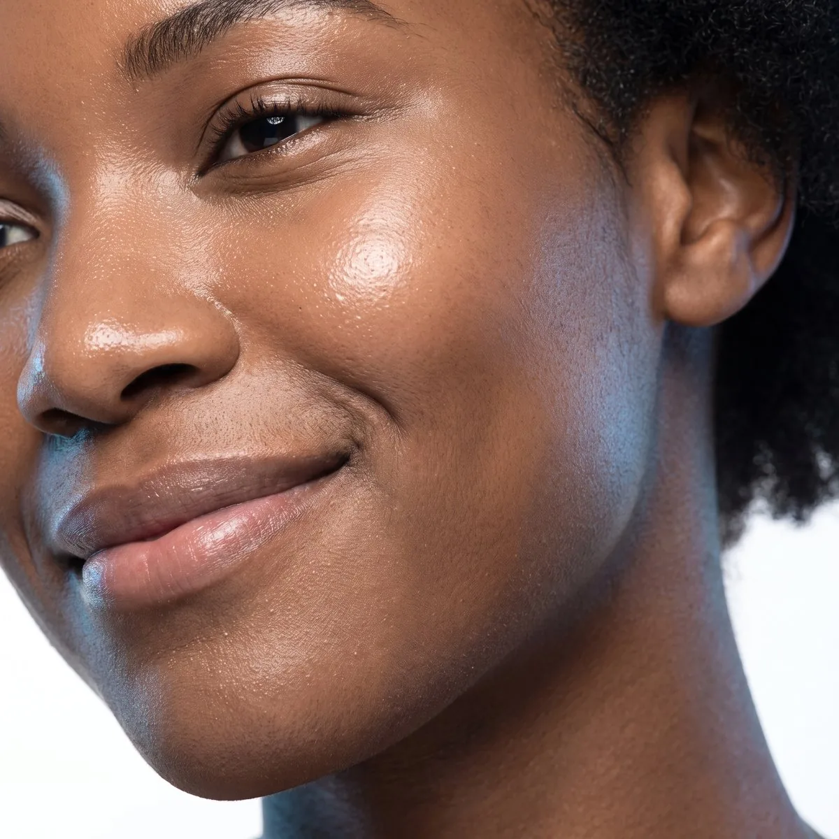 Acne scar treatment at BHRC