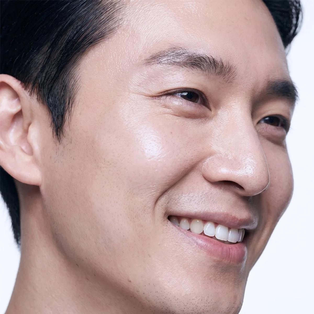 Close-up of the temple area after acne scar treatment at BHRC