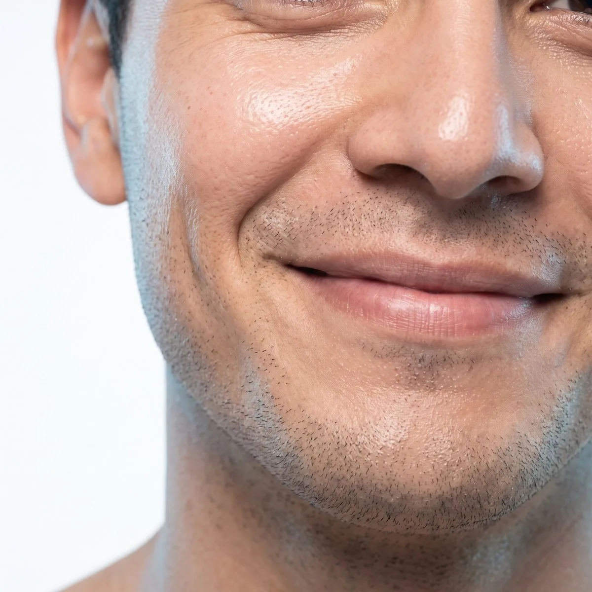 Close-up of softened nasolabial folds after treatment at BHRC
