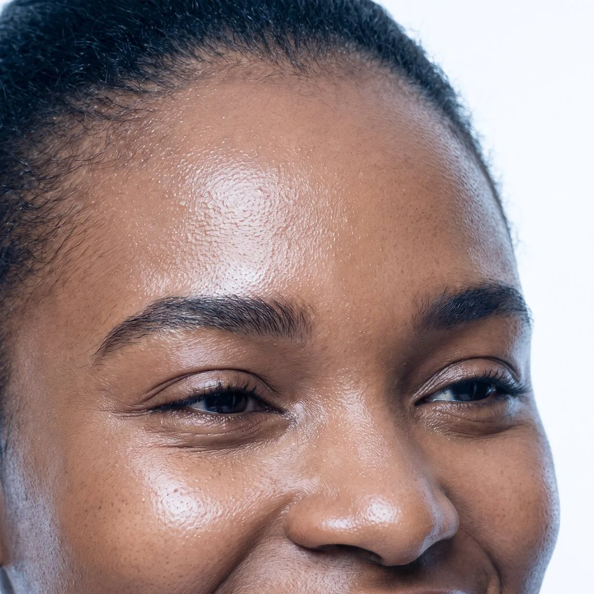Close-up of a smooth forehead after anti-aging treatment at BHRC