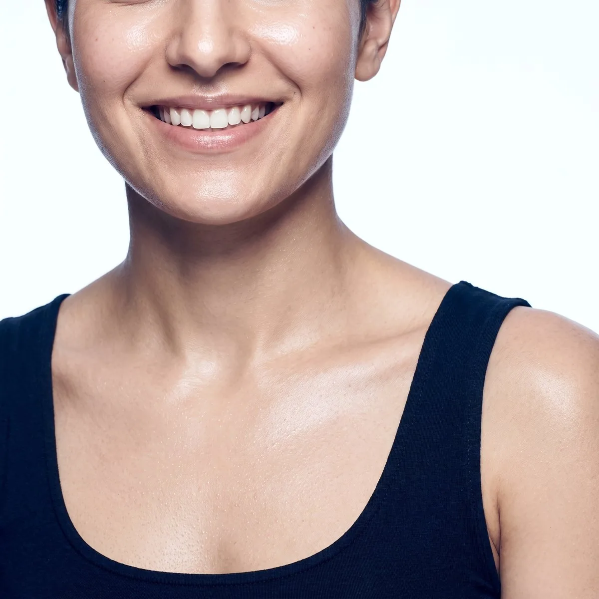 Close-up of the decolletage after diluted Sculptra at BHRC