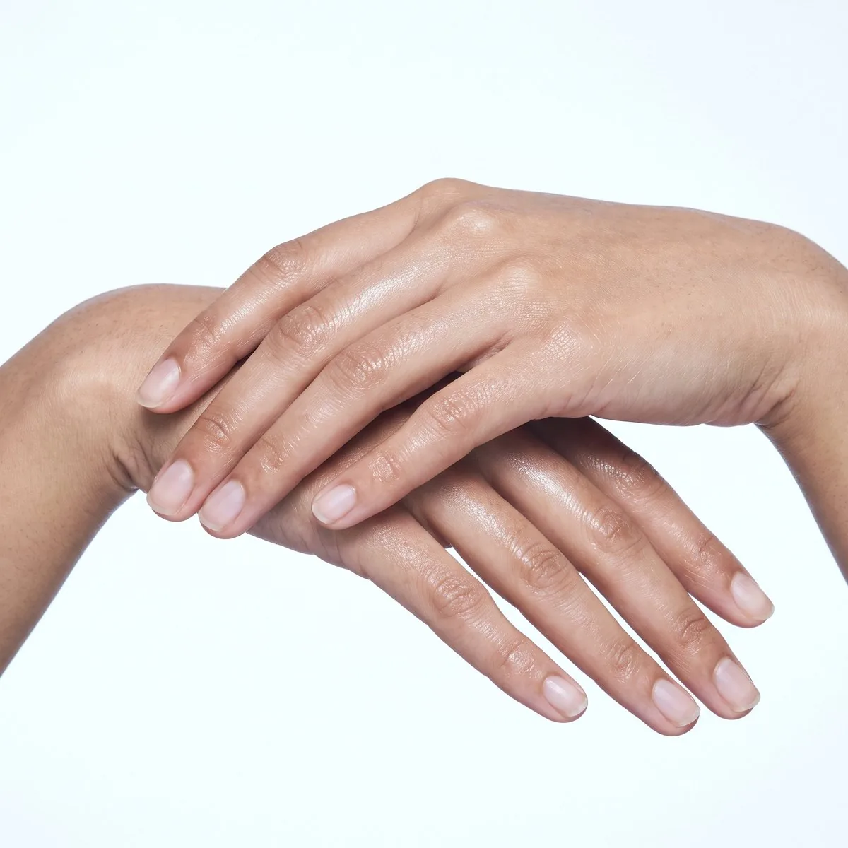 Hand rejuvenation with Restylane Lyft at BHRC