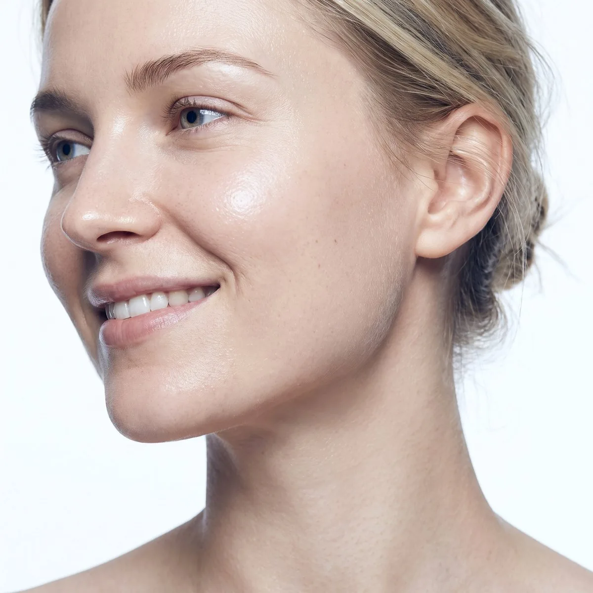 Close-up of a defined jawline after Radiesse at BHRC