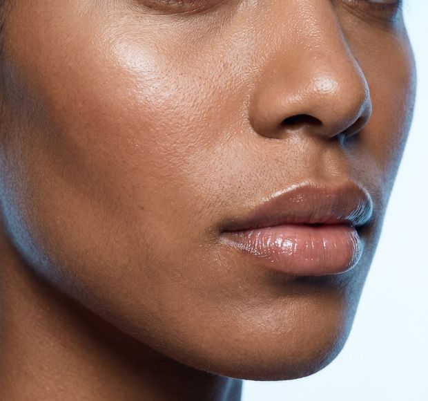 Dermal filler treatments at BHRC