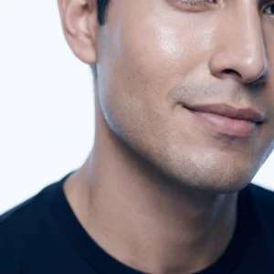 CO2 Laser Resurfacing in Henderson: Acne scars