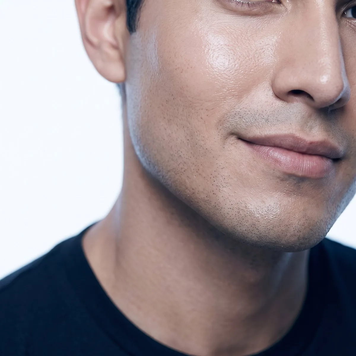 Close-up of a cheek with improved acne scarring after CO2 laser at BHRC