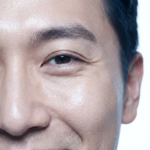 CO2 Laser Resurfacing in Henderson: Around the eyes