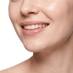 CO2 Laser Resurfacing in Henderson: Lines around the mouth