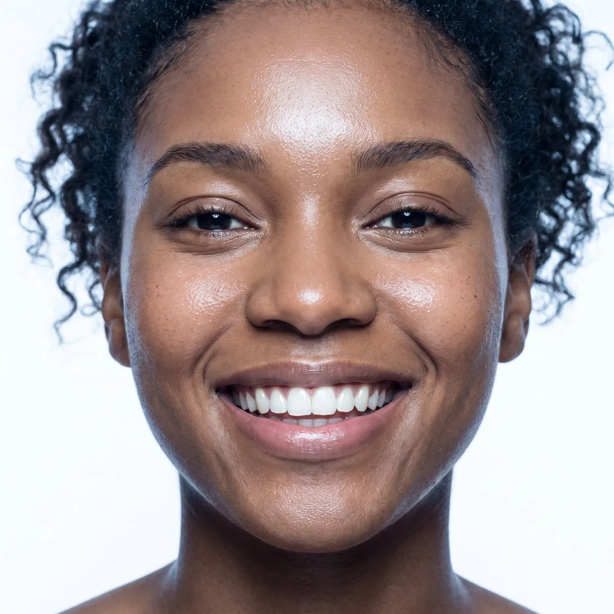 A chemical peel treatment at BHRC