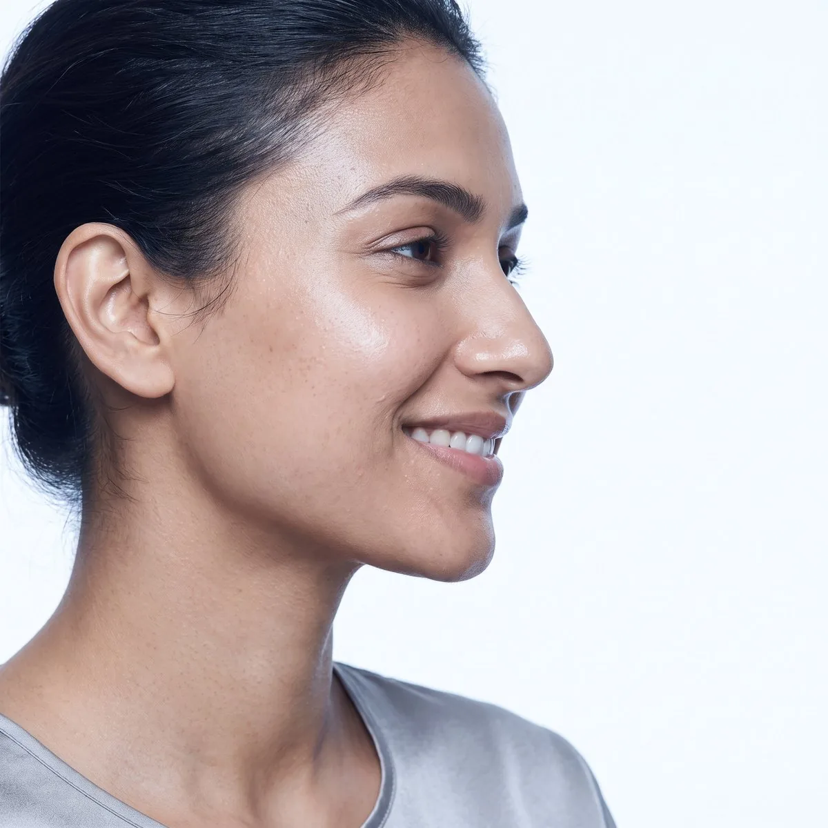 Side profile showing a defined chin and neck after treatment at BHRC