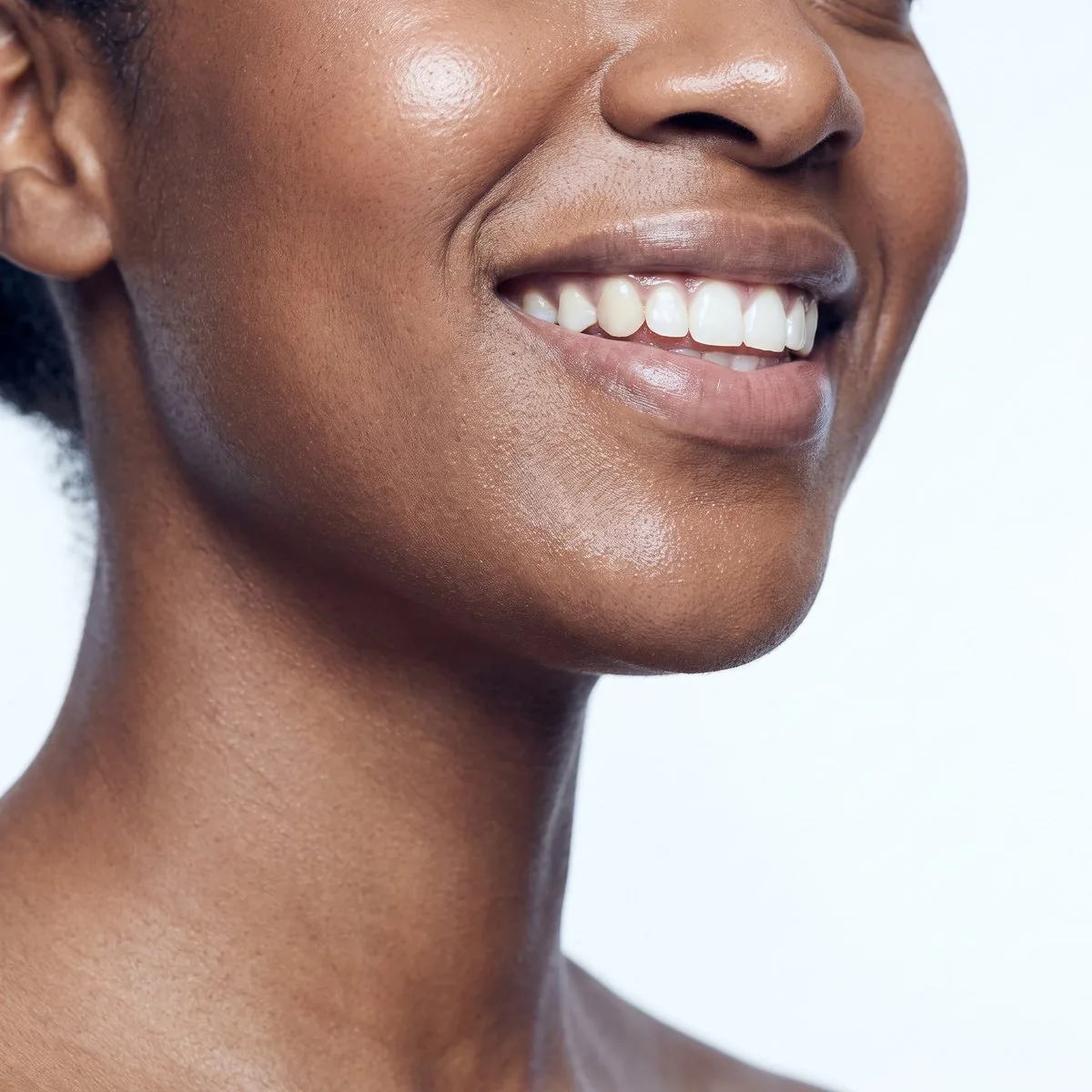 Kybella treatment at BHRC