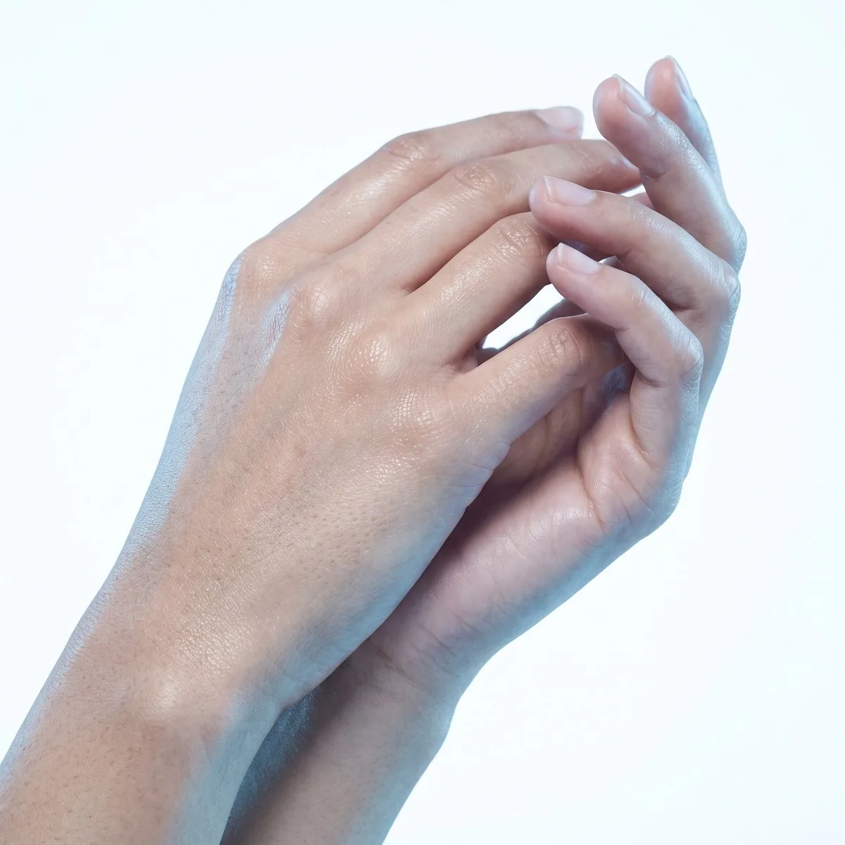 Close-up of the backs of the hands after filler at BHRC