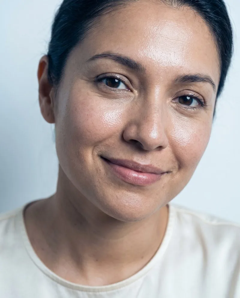 Close-up of a BHRC patient with radiant skin