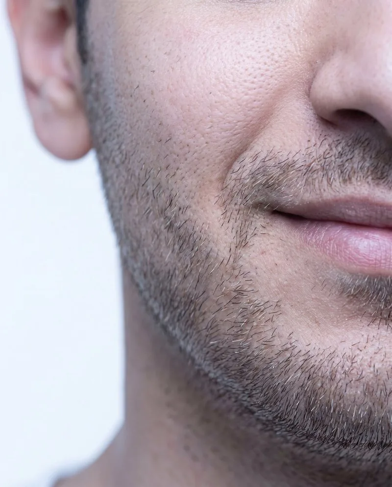Close-up detail of clear, smooth skin