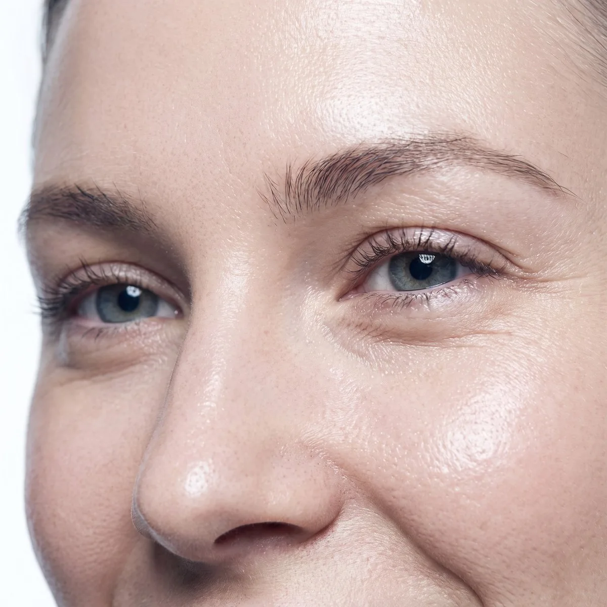 Close-up of a brightened eye area after a HydraFacial at BHRC