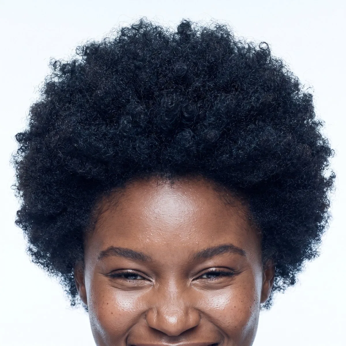 Close-up of a dense crown after hair restoration at BHRC