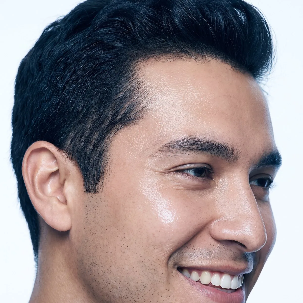 Close-up of dense temples after hair restoration at BHRC