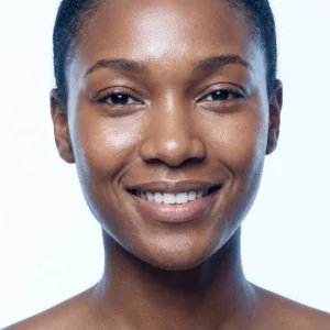 IPL Photofacial in Henderson: Face