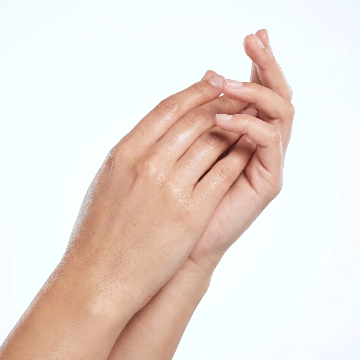 Close-up of the backs of the hands after IPL at BHRC