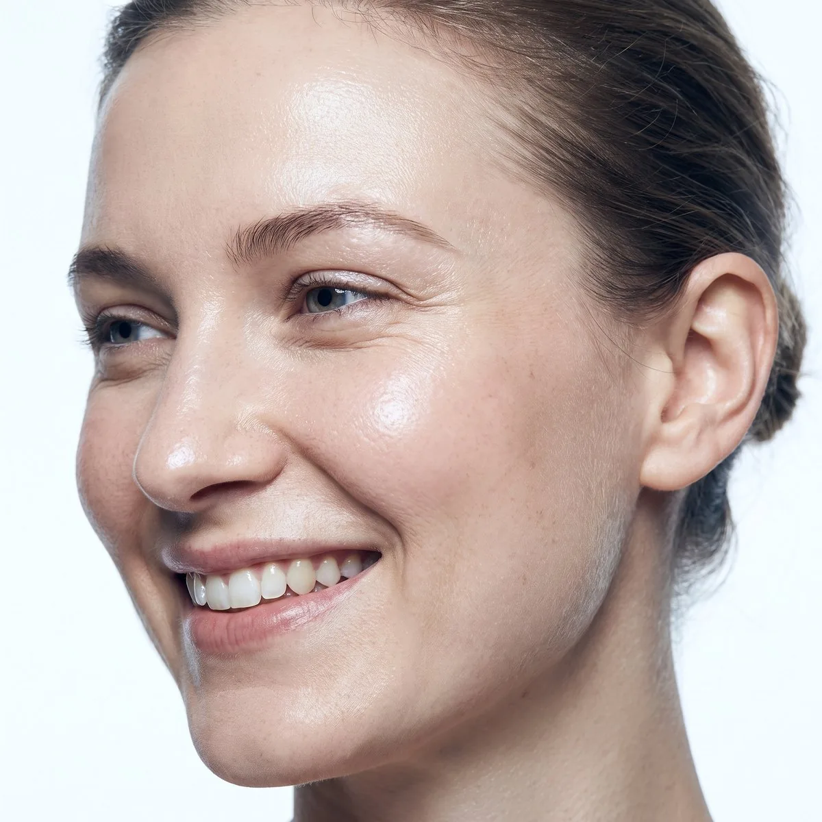 Close-up of skin cleared of sun spots after IPL at BHRC