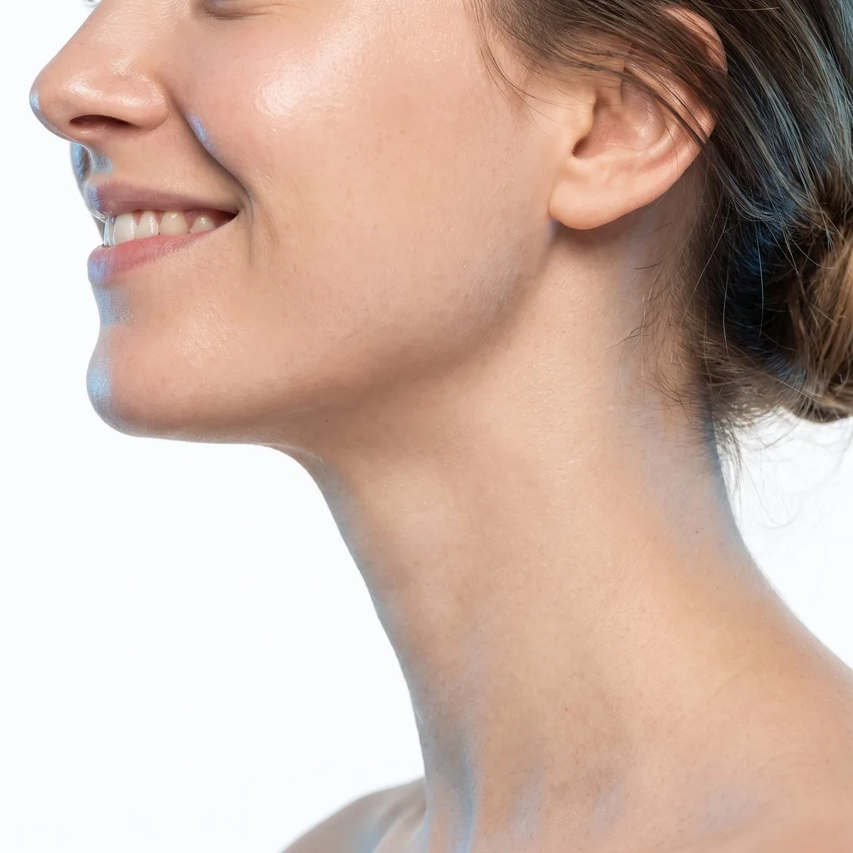 Side profile showing a defined chin and neck after Kybella at BHRC