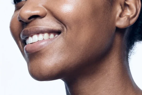 Kybella at BHRC Paradise Valley