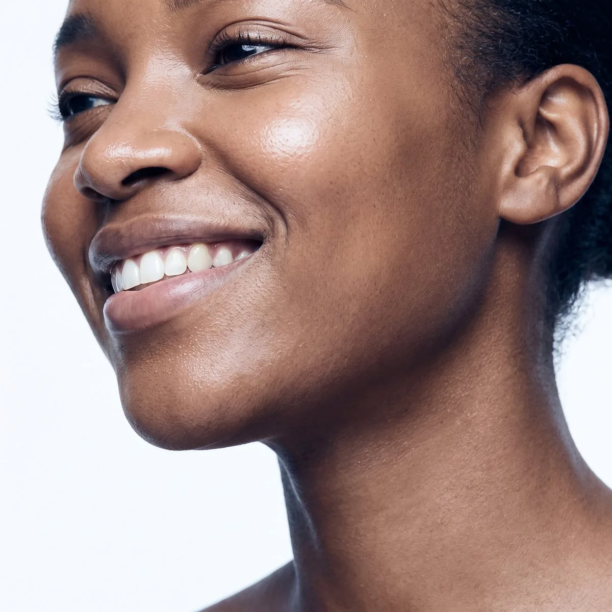 Kybella at BHRC