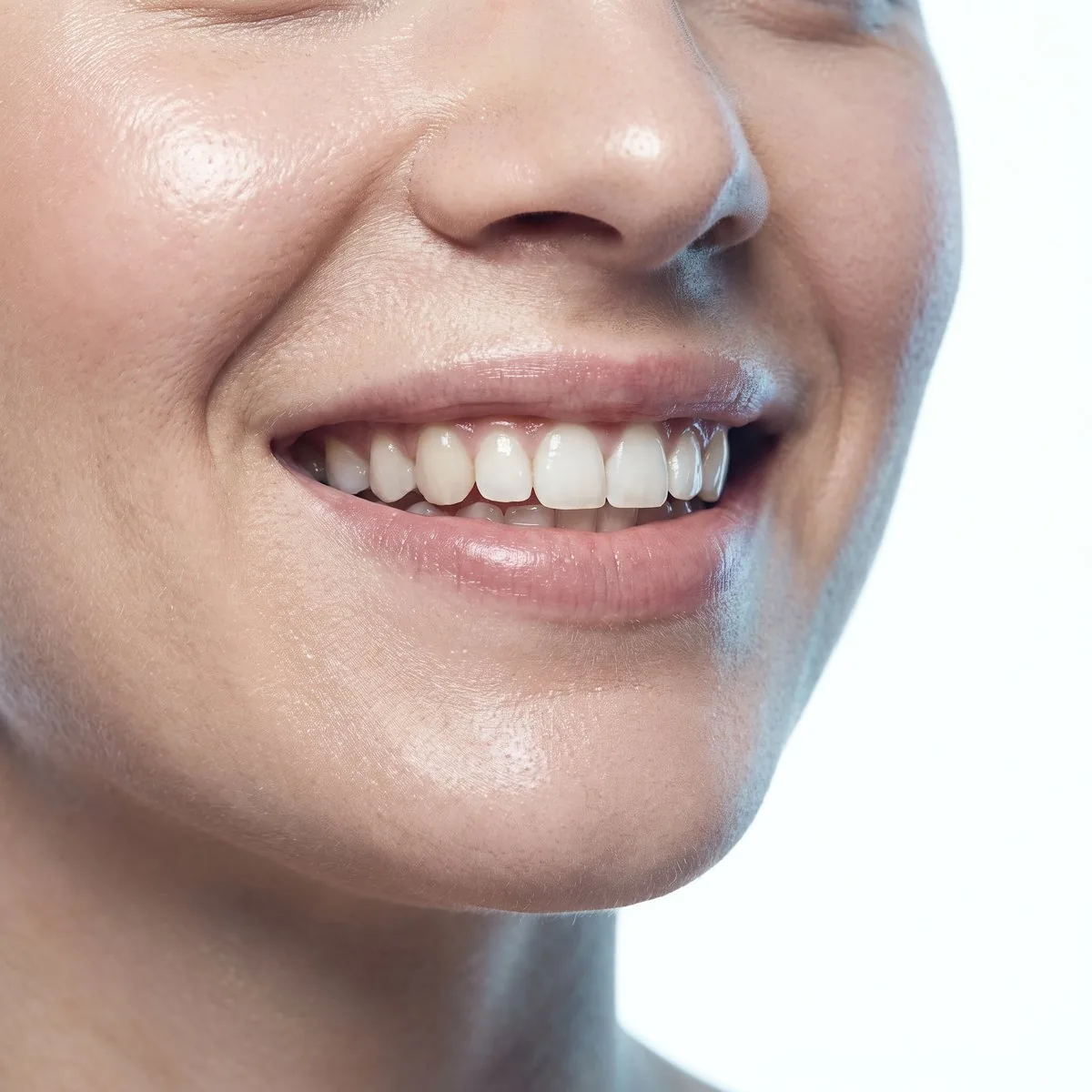 Close-up of an upper lip after a lip flip at BHRC