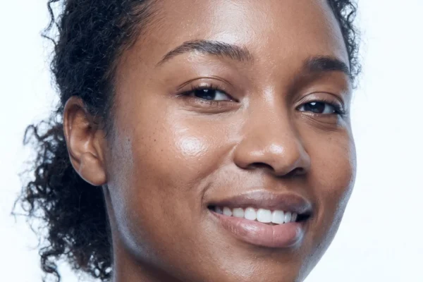 Microneedling at BHRC Henderson