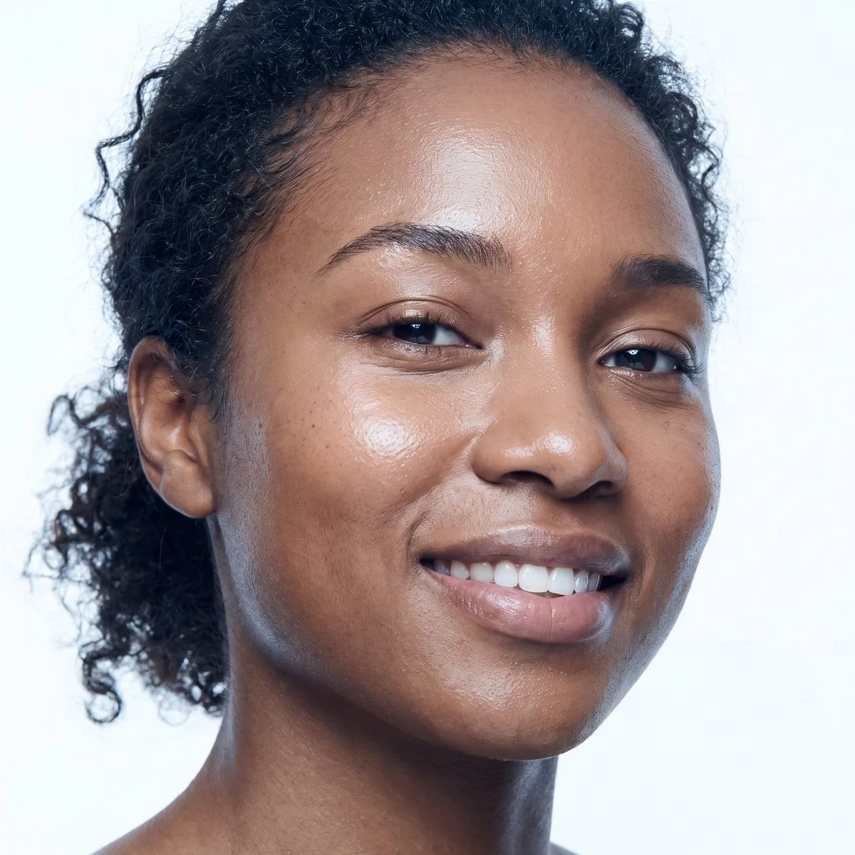 Rejuran with microneedling at BHRC