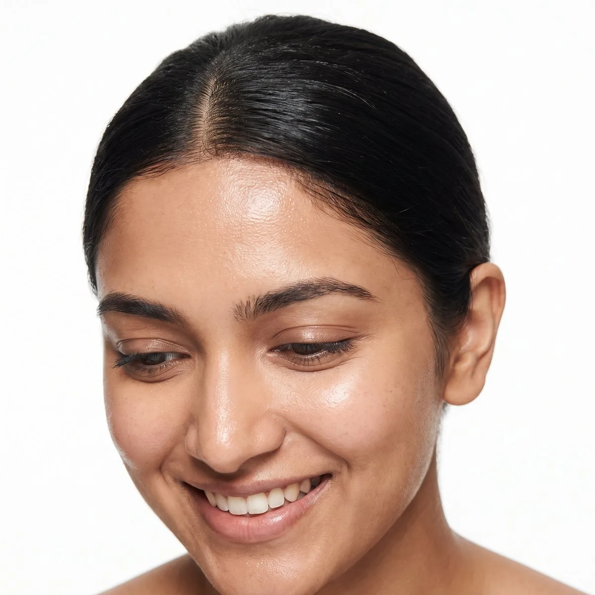 The hairline and scalp treated with microneedling at BHRC