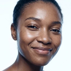 PRP in Henderson: PRP facial