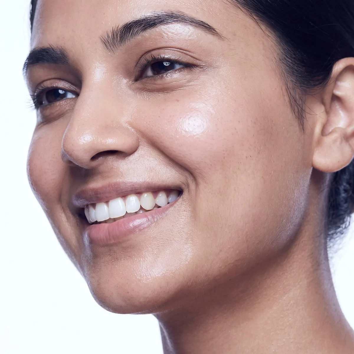 Rejuran for acne scarring at BHRC