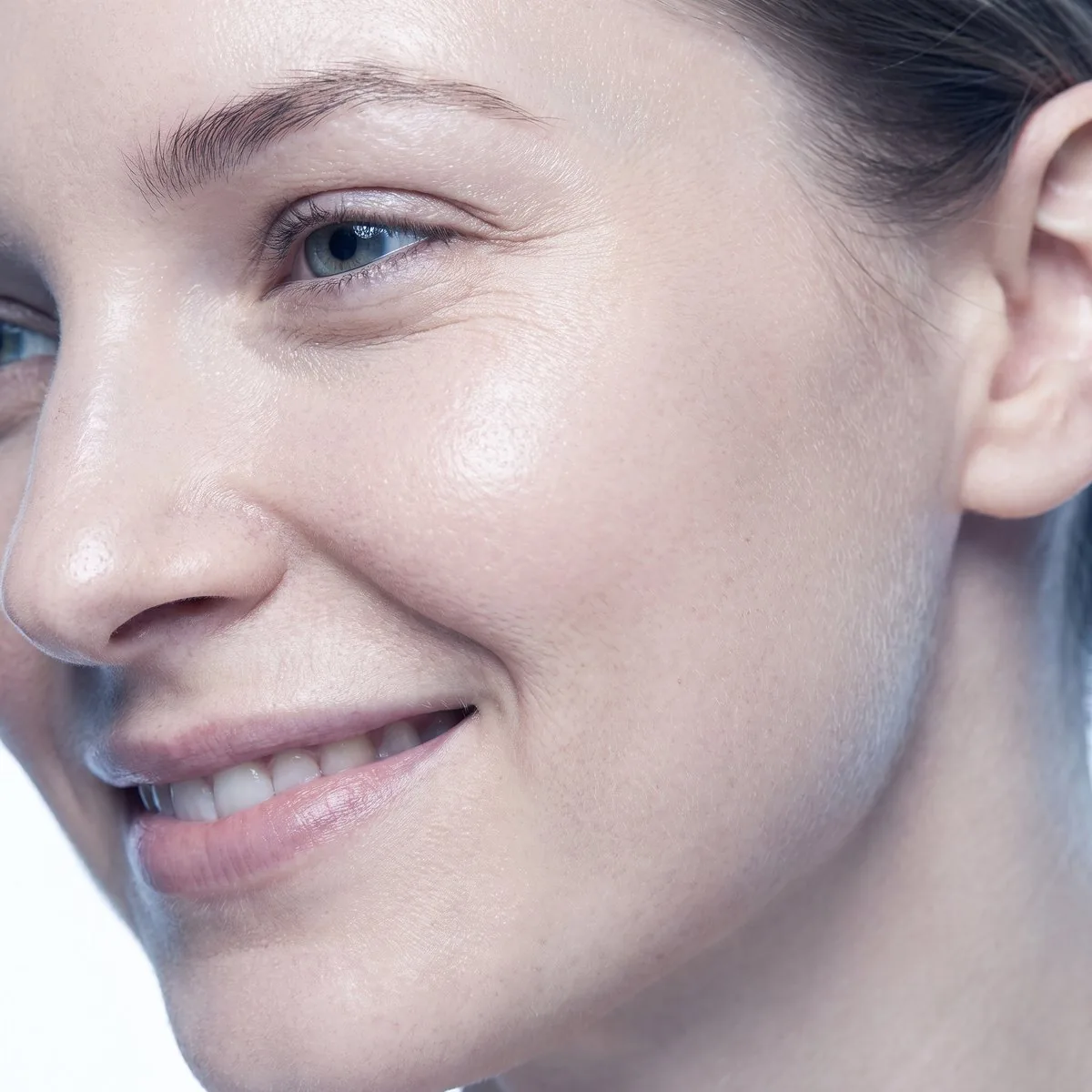 Rejuran cheek treatment at BHRC