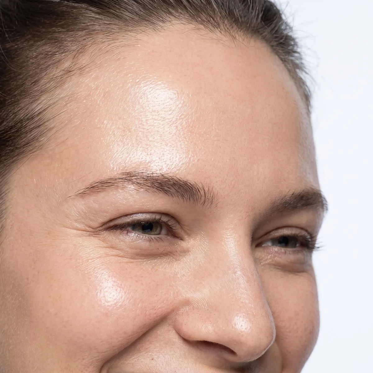 Close-up of an even forehead after pigmentation treatment at BHRC
