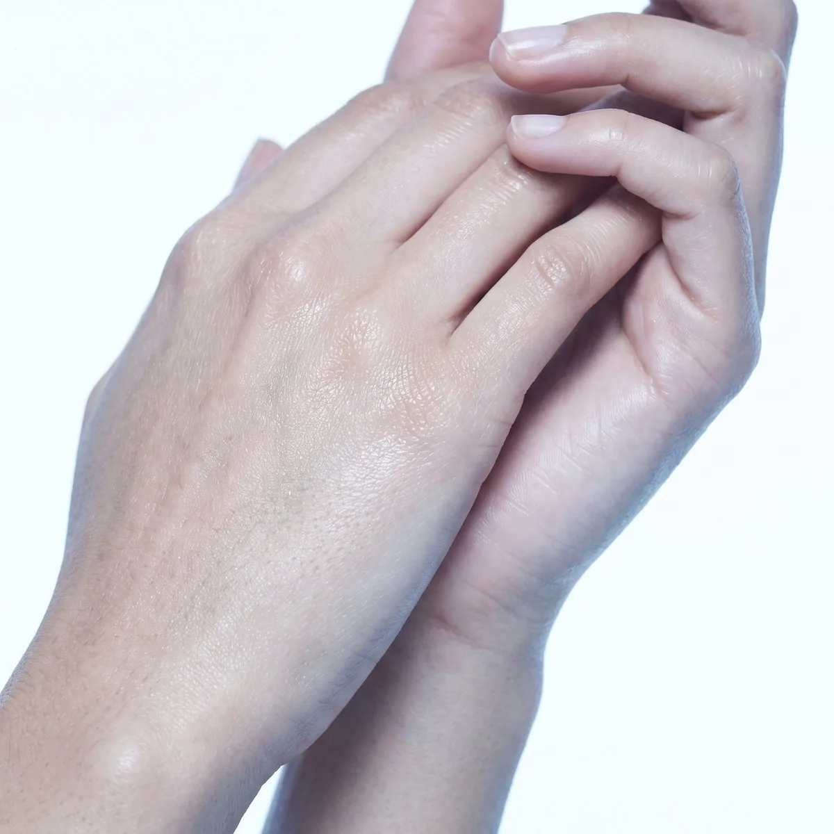 Close-up of the backs of the hands after pigmentation treatment at BHRC