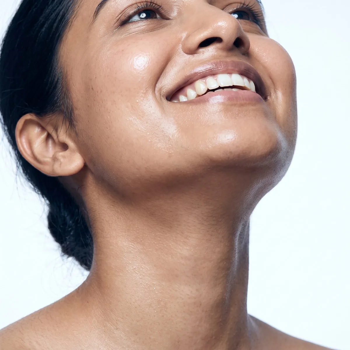 Close-up of a tightened neck after Ultherapy at BHRC