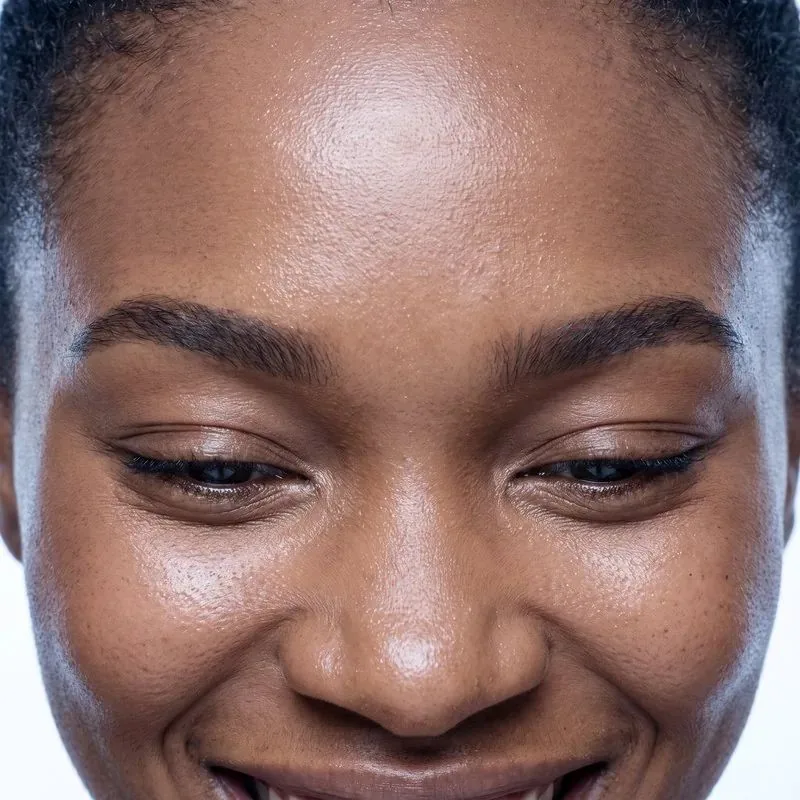 Close-up of a smooth forehead after Botox treatment at BHRC.