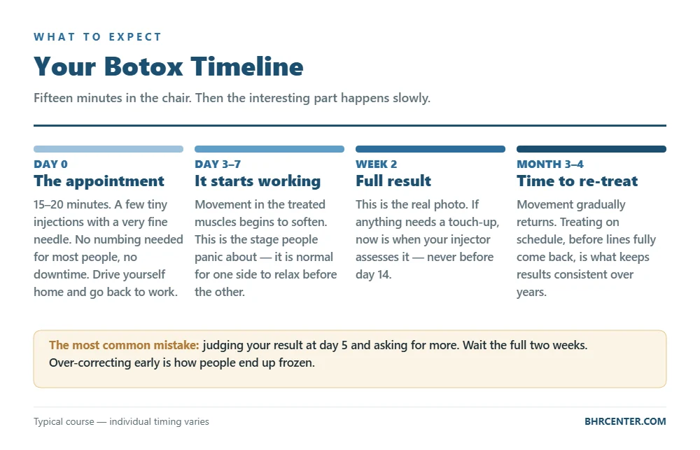 Botox results timeline from day zero through month four